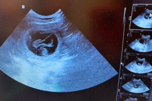 I Abbys mage är det liv och rörelse.